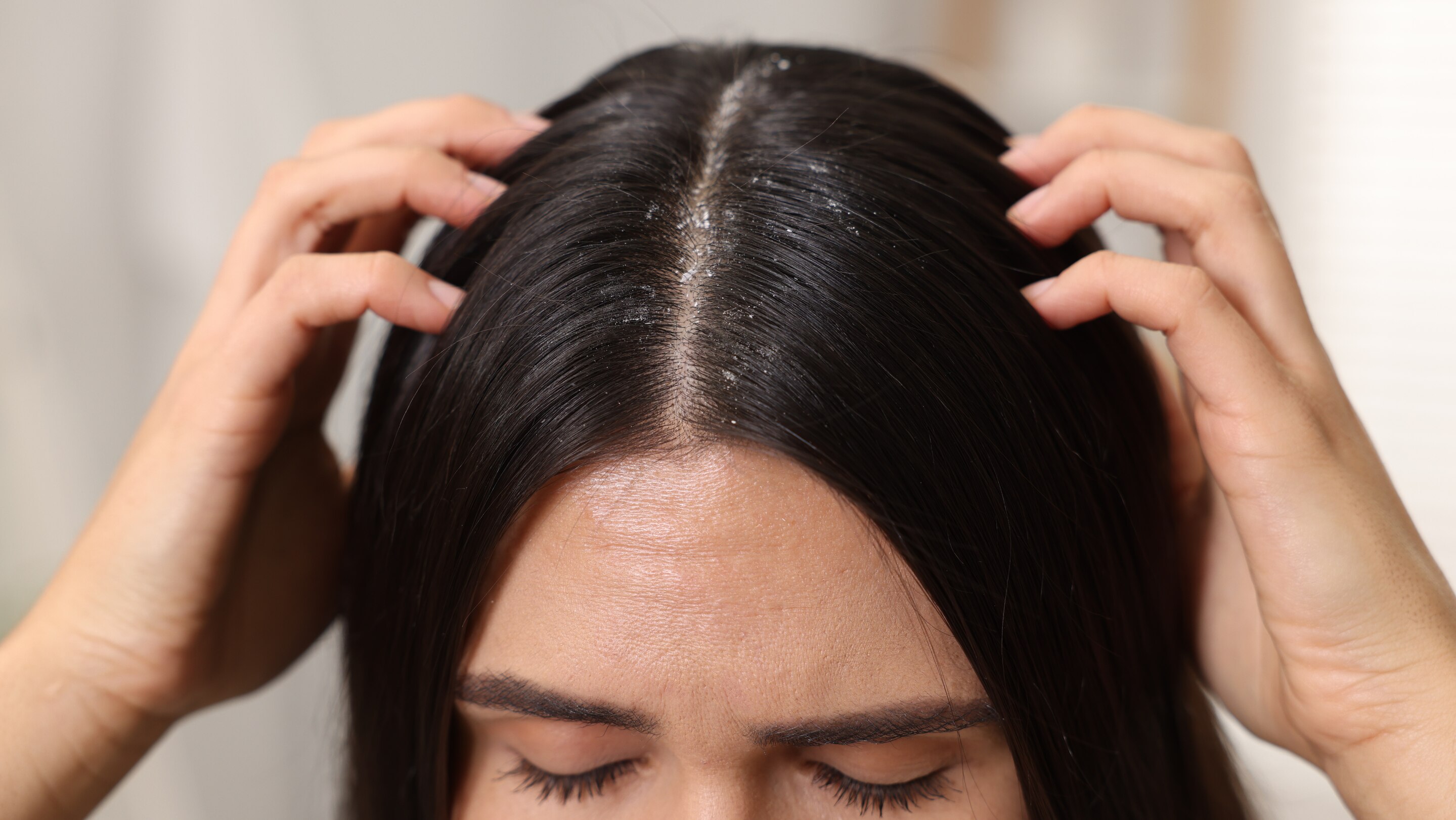 Helps reduce dandruff and scalp dryness: