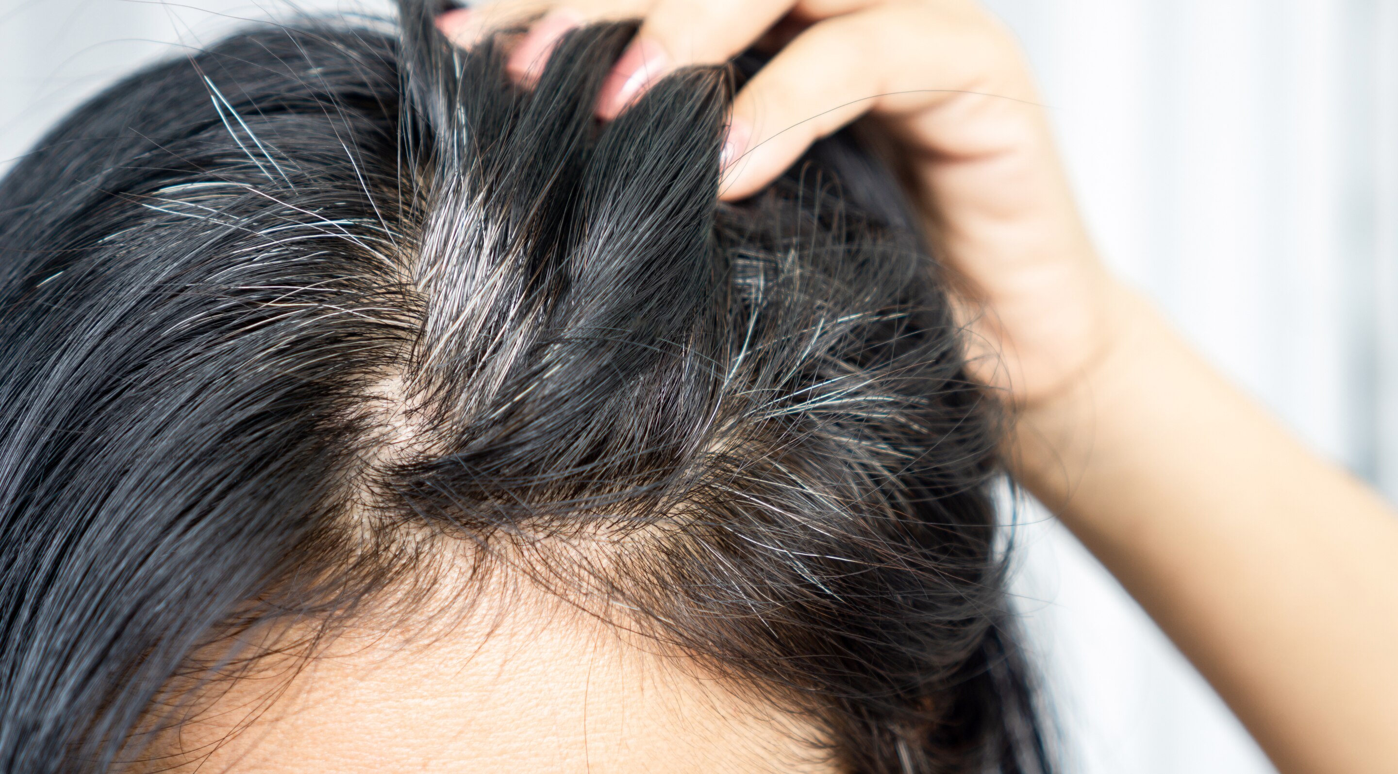 6. May Help Prevent Premature Greying