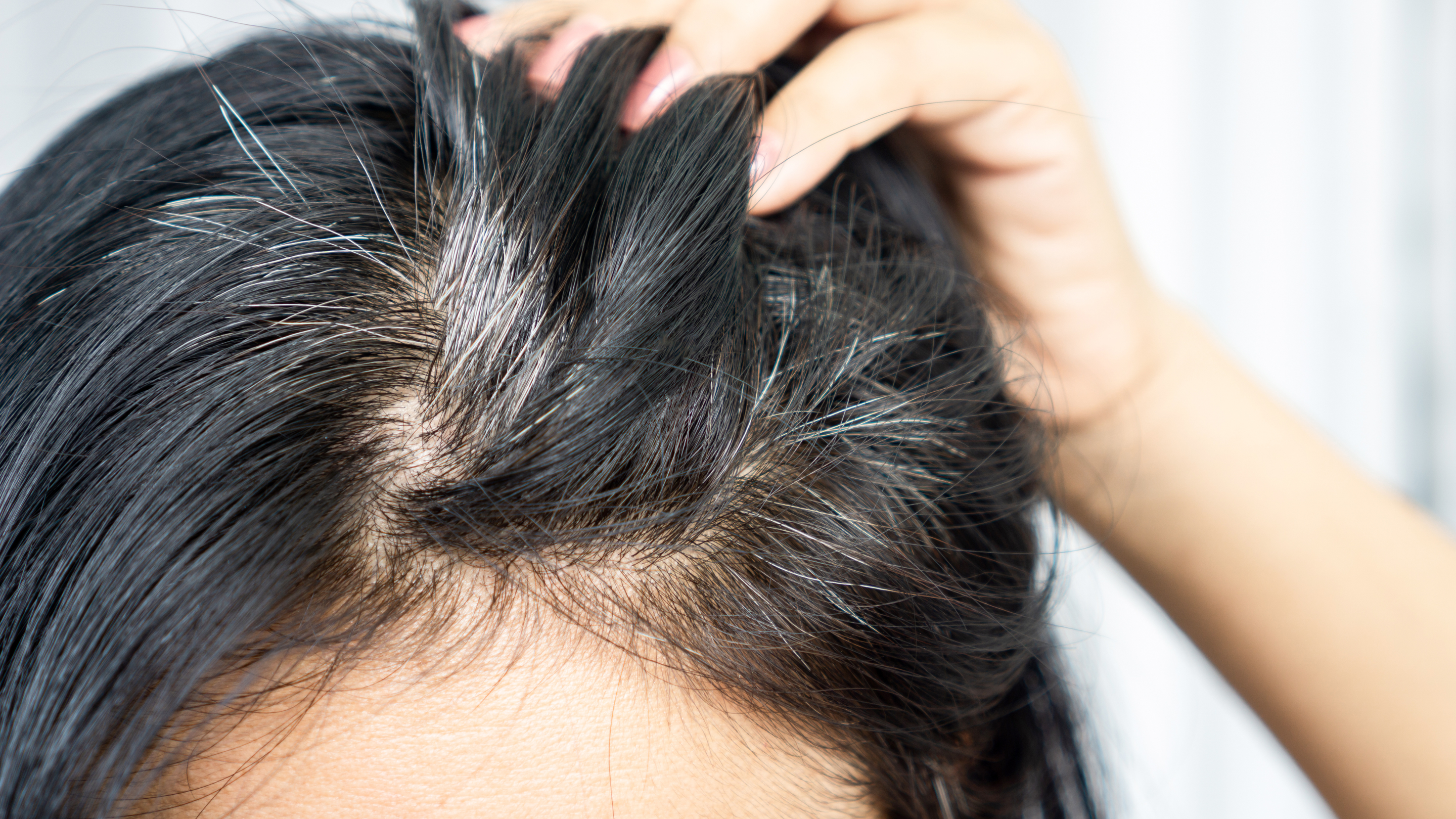 6. May Help Prevent Premature Greying