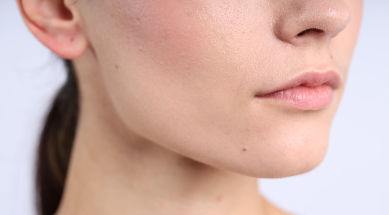 7. Pore Tightening and Refinement