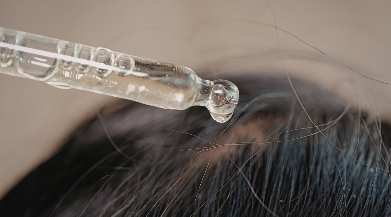 4. Step 4: Apply to Scalp