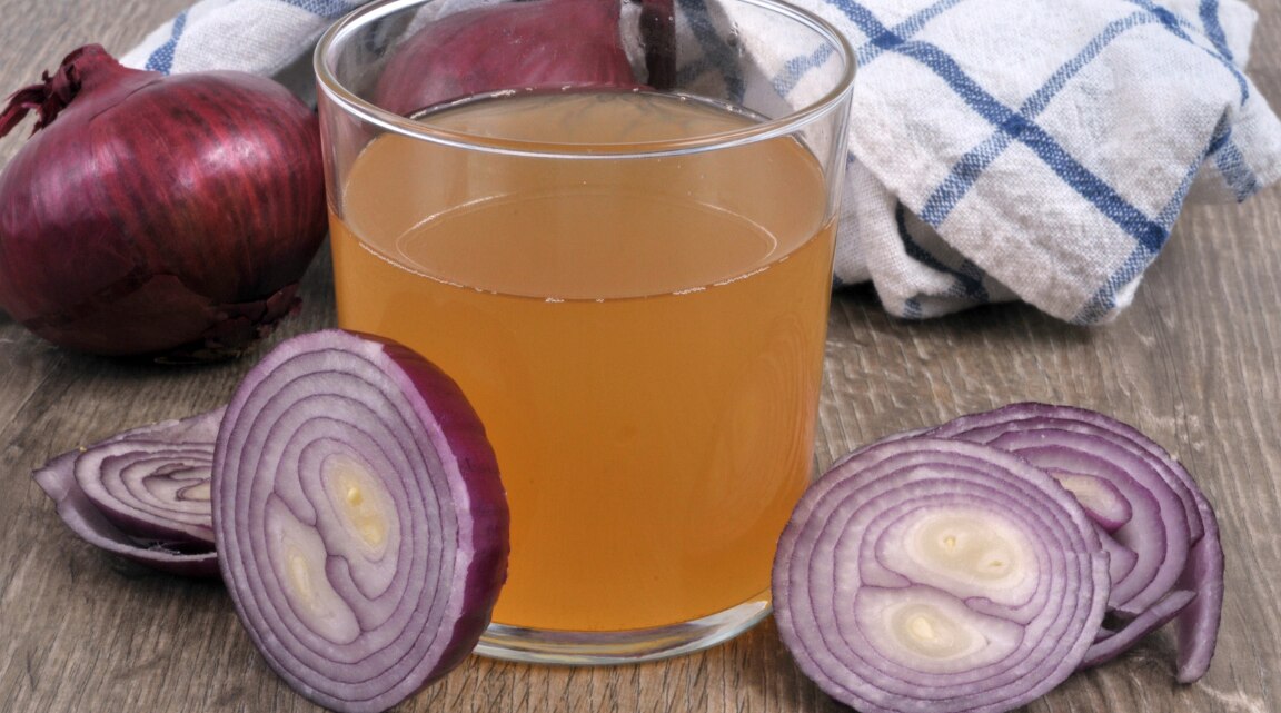 Onion Juice for Dandruff Benefits and How to Use