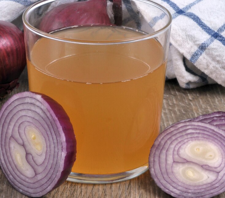 Image of Onion Juice for Dandruff: Key Benefits, How to Make & How to Use It