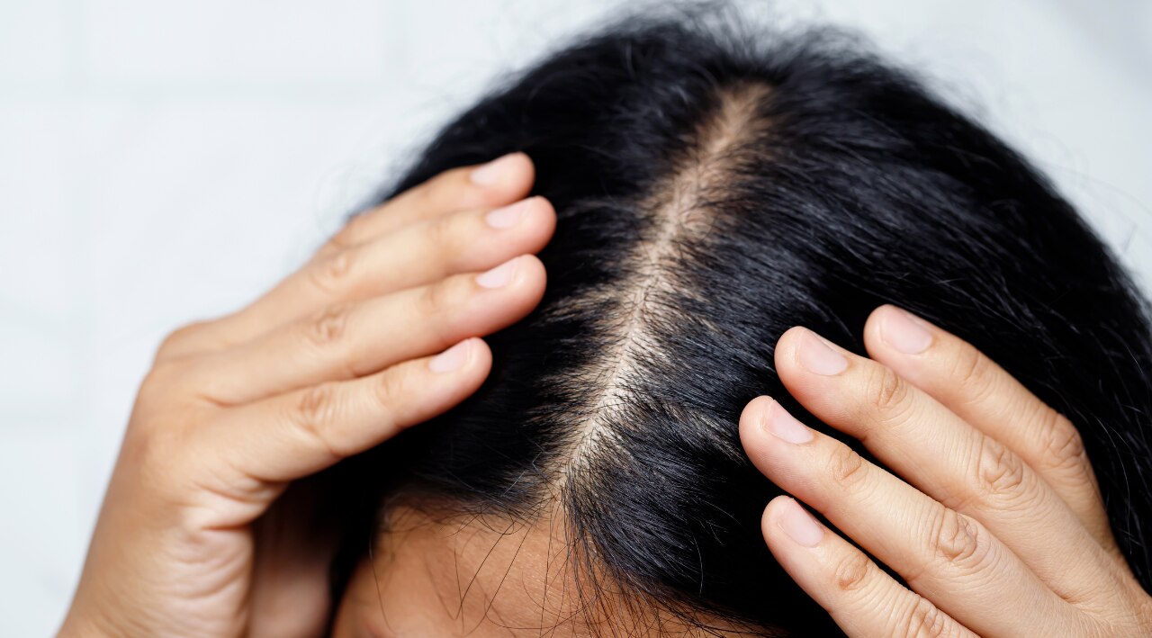 Soothees the  Scalp