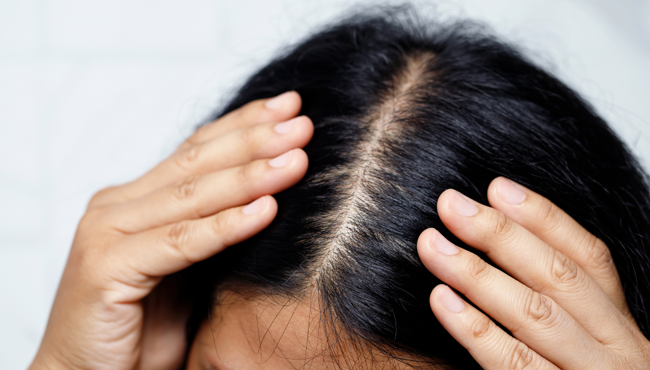 Soothees the Scalp