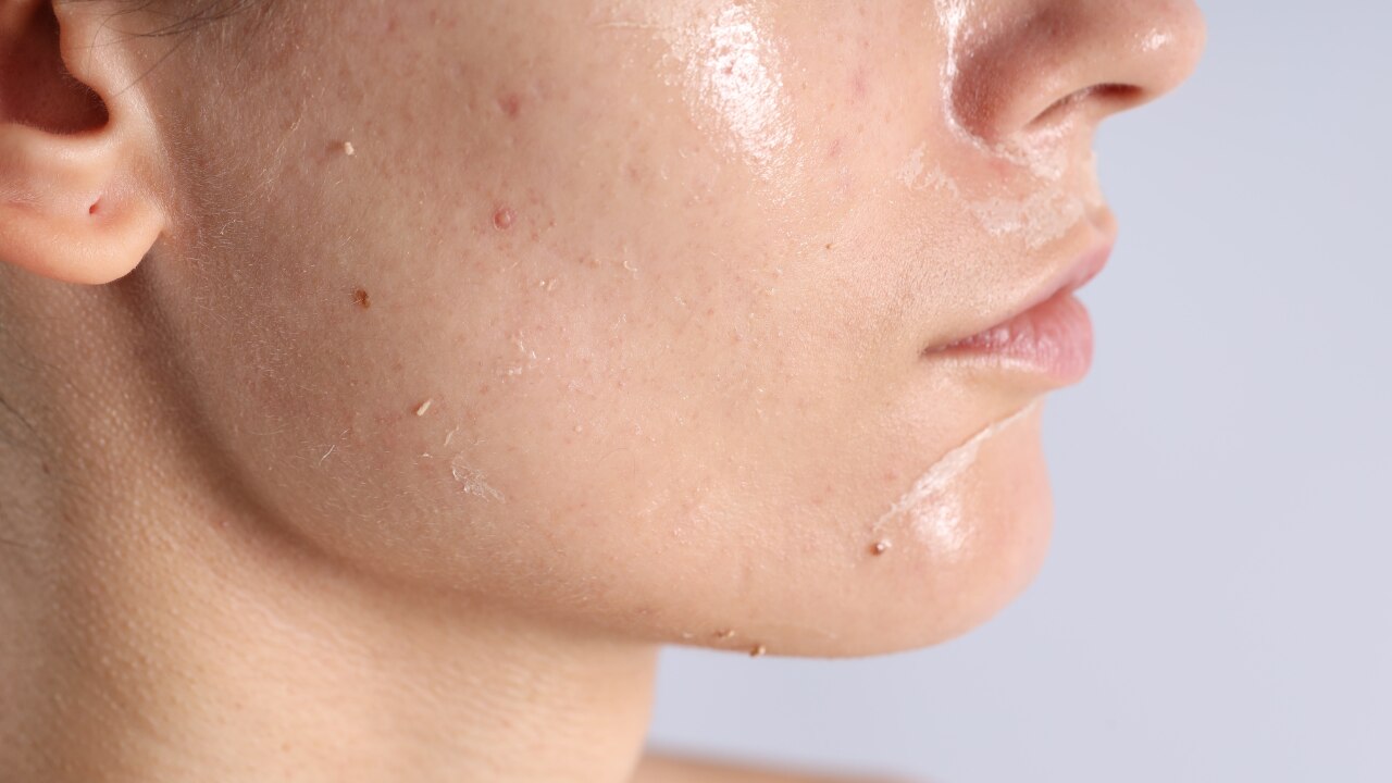 For Combination Skin