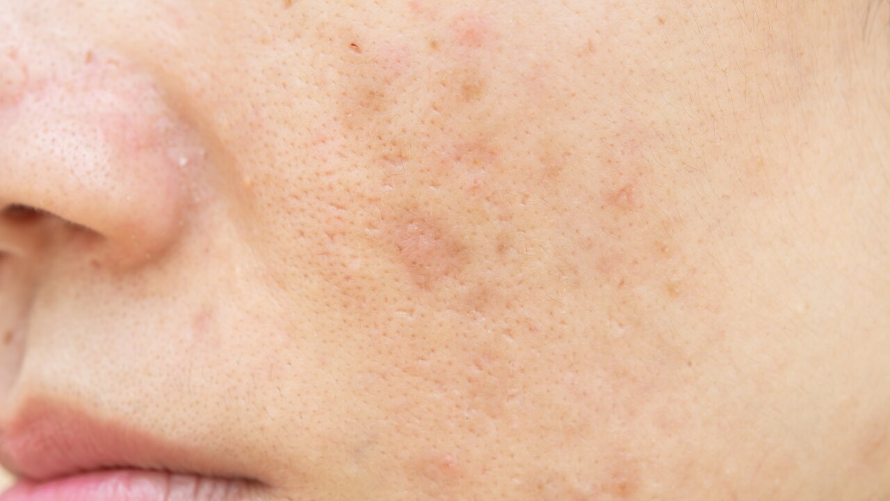 For Dull Skin