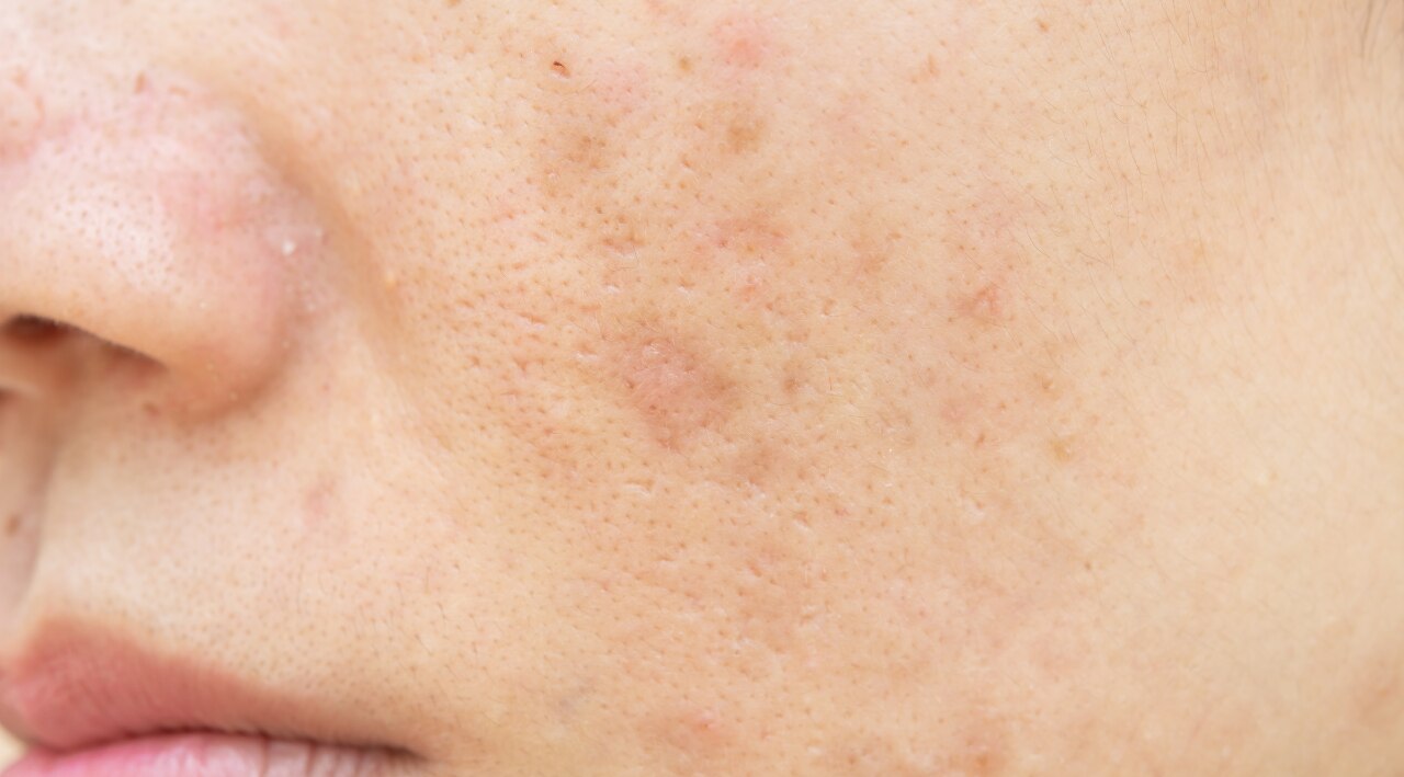 For Dull Skin