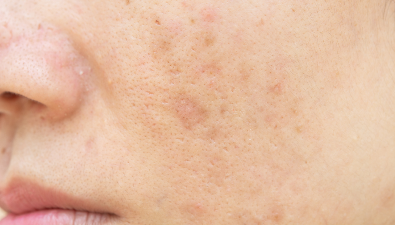For Dull Skin