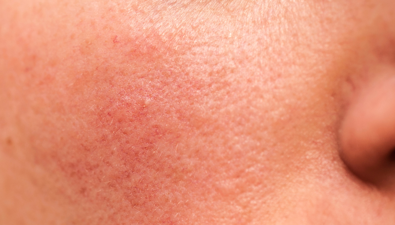For Sensitive Skin