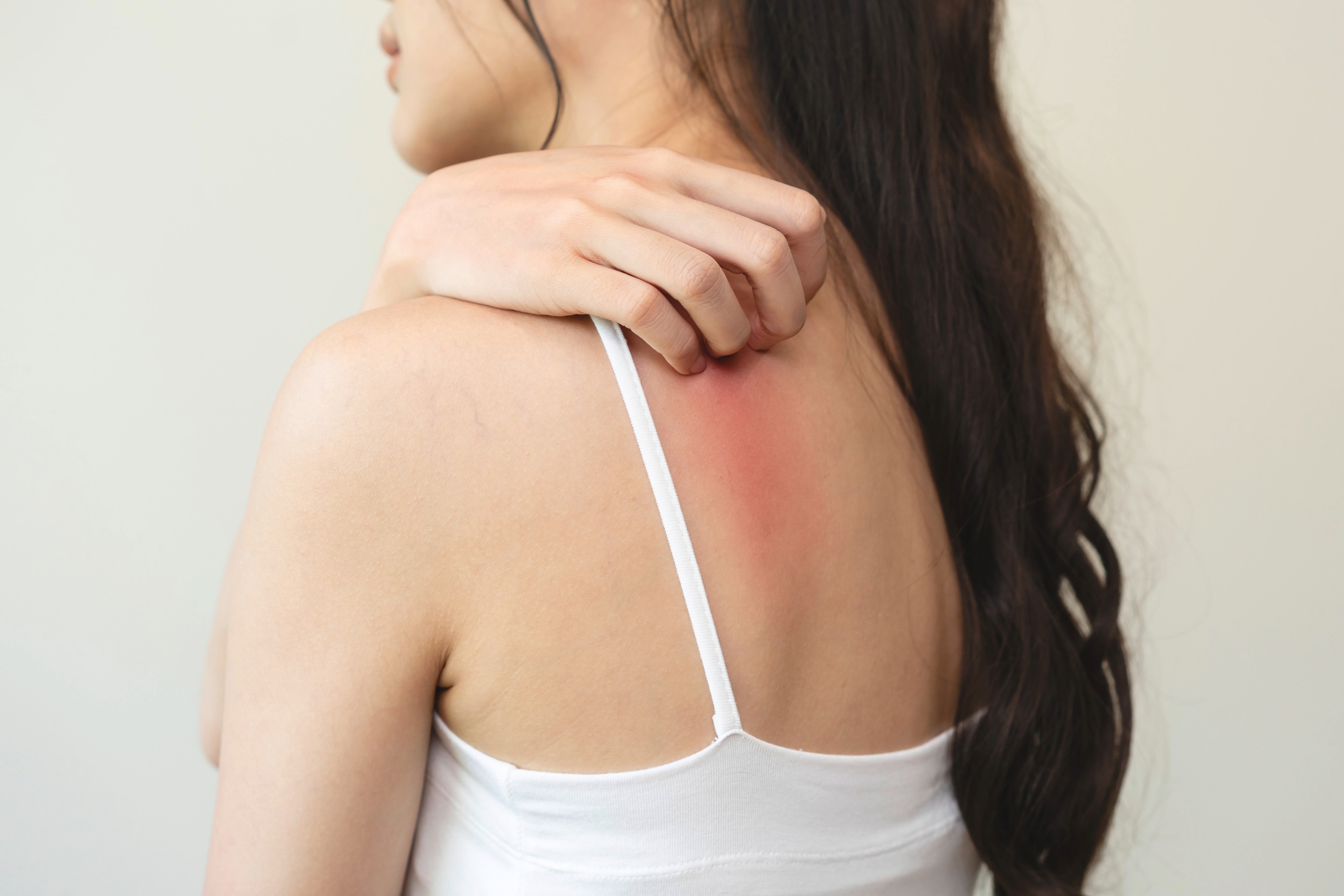 wanita Asia sedang menggaruk area punggung