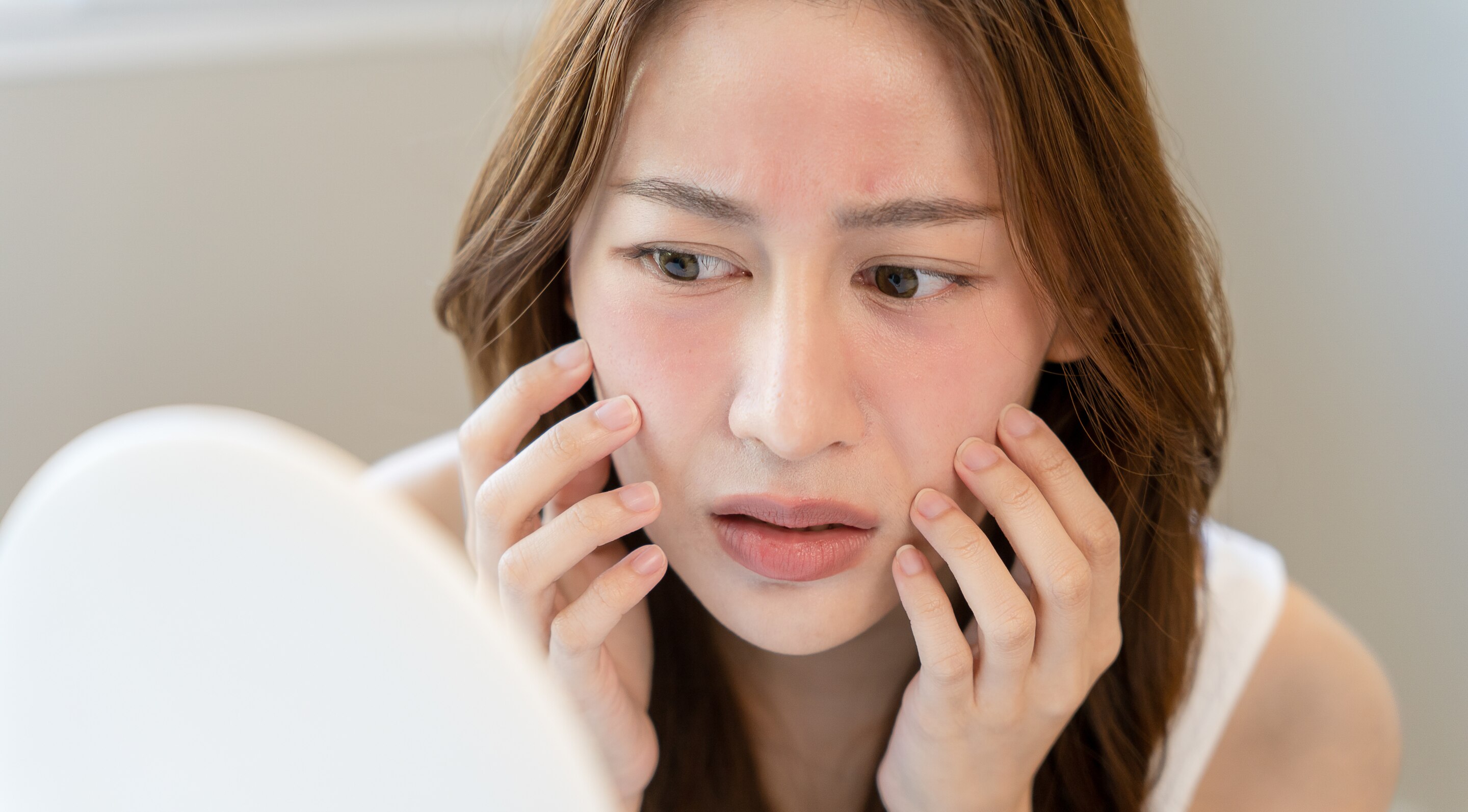 Reduces Redness and Soothes Rosacea:
