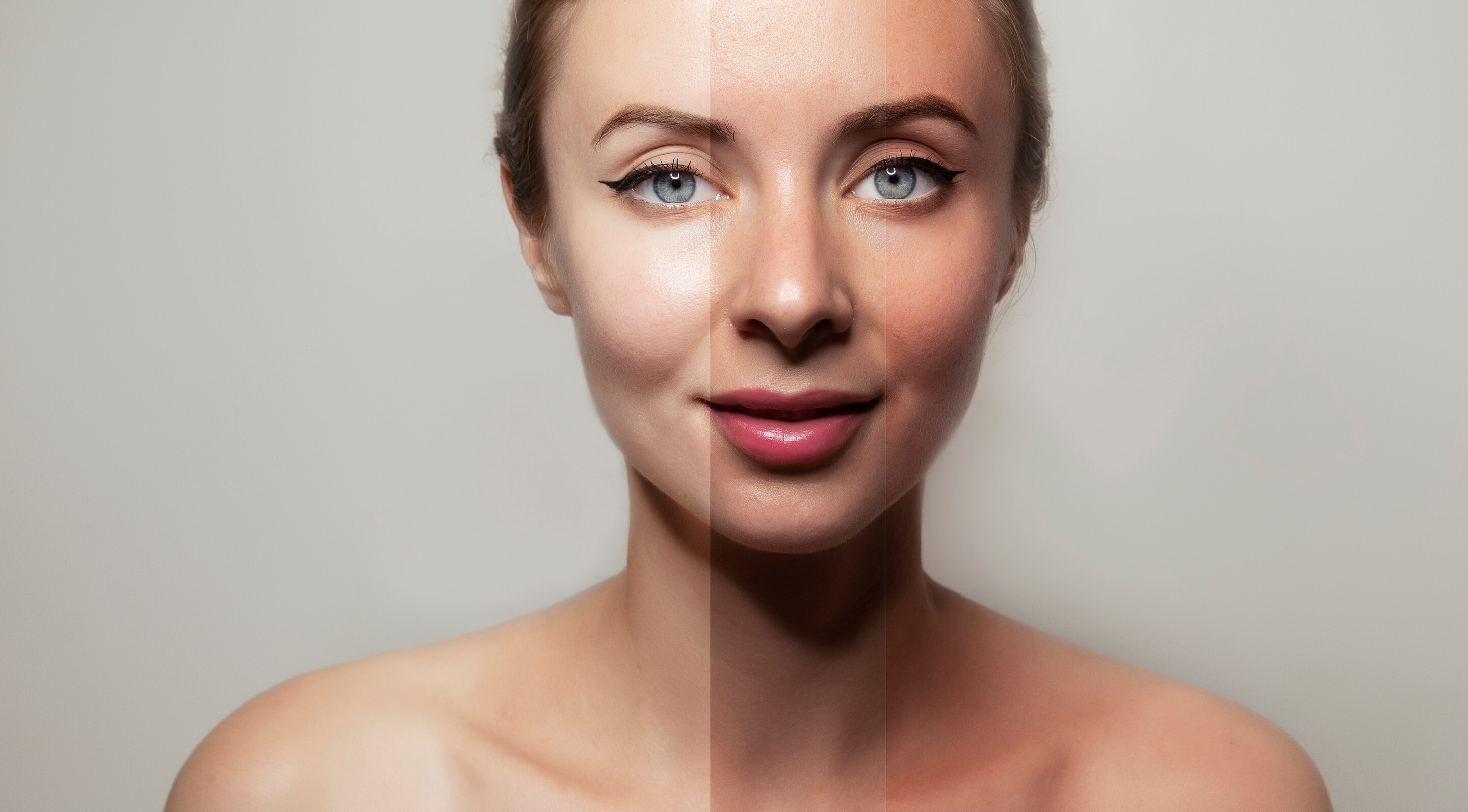 Minimises tanning & pigmentation:
