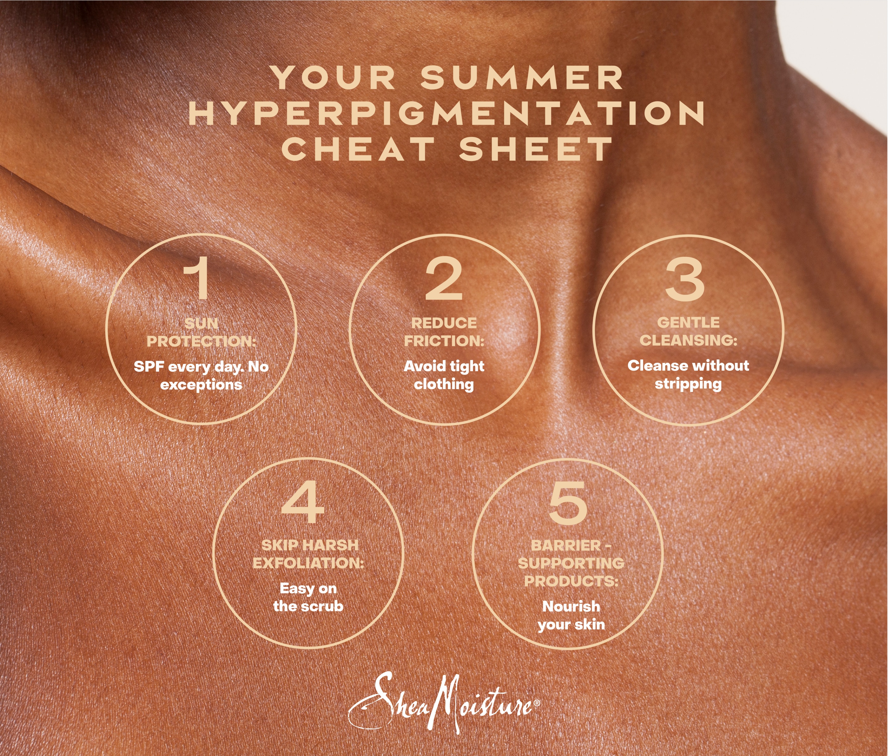 Summer Hyperpigmentation Cheat Sheet