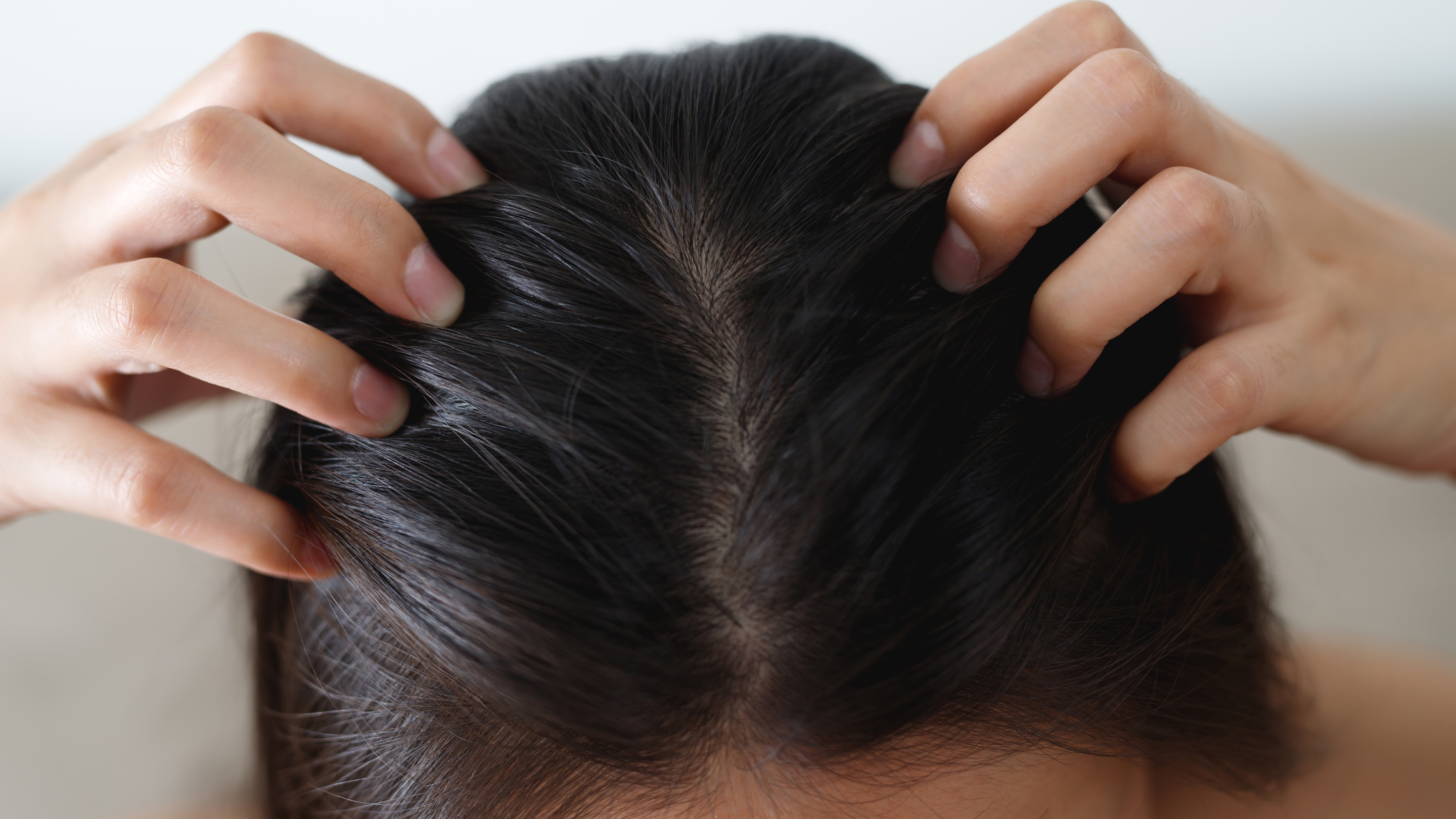 2. Improves Scalp Health: