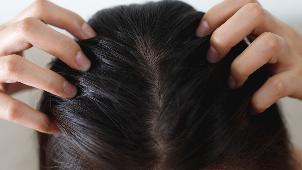 Focus on Scalp Health First: