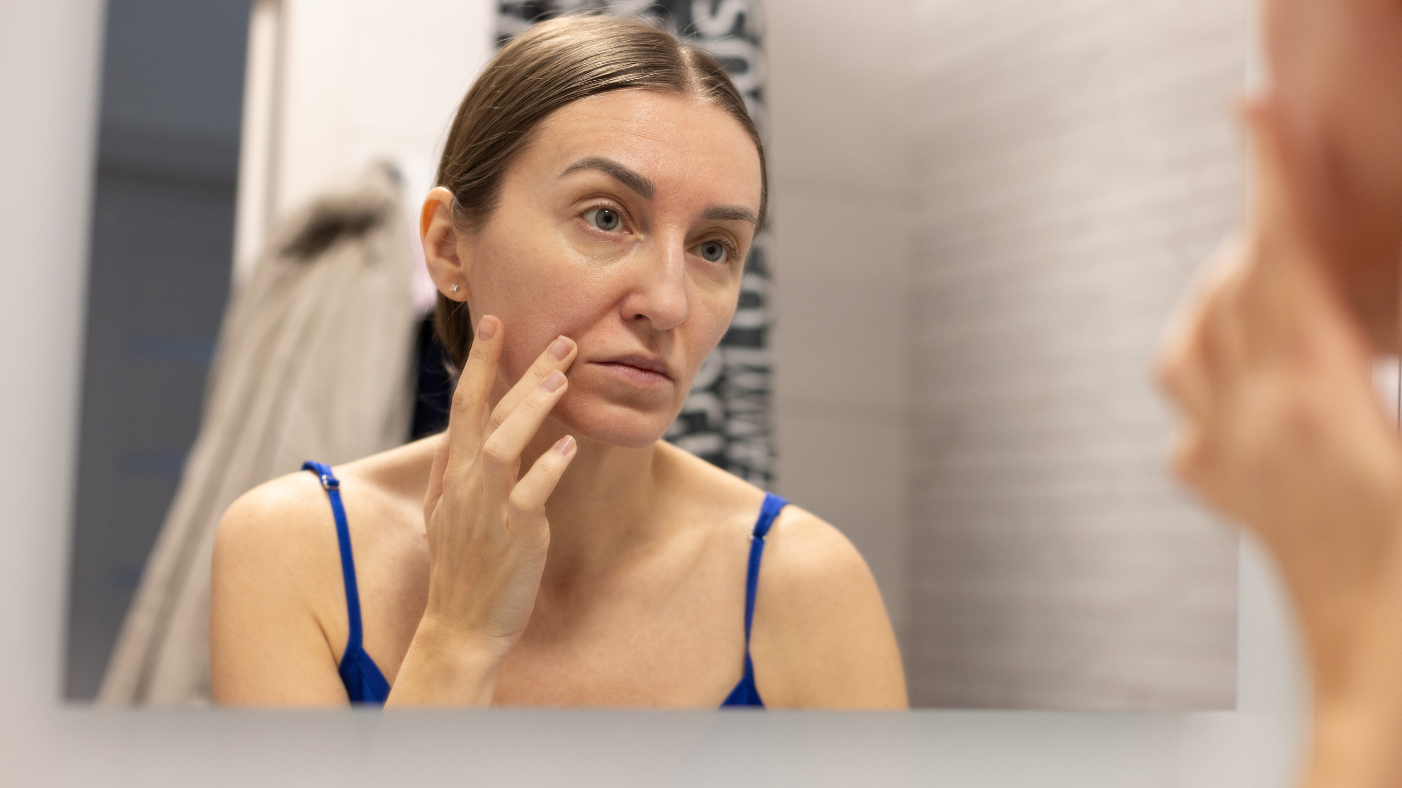 Oil Control & Acne Treatment