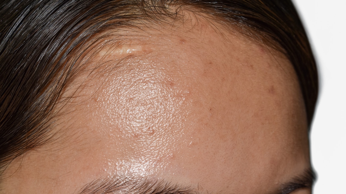 linking article: Summer Skincare Routine for Oily Skin: Steps & Natural Care Tips