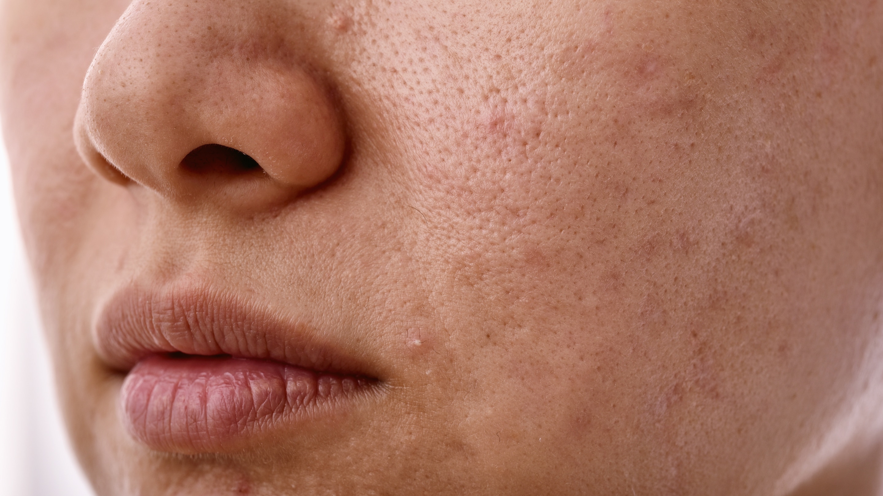 Benefits for Sensitive Skin