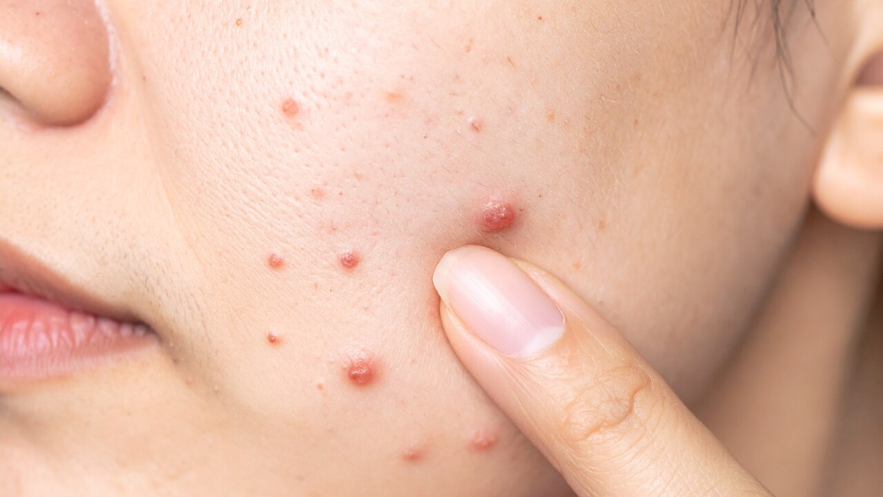 Side Effects & Precautions