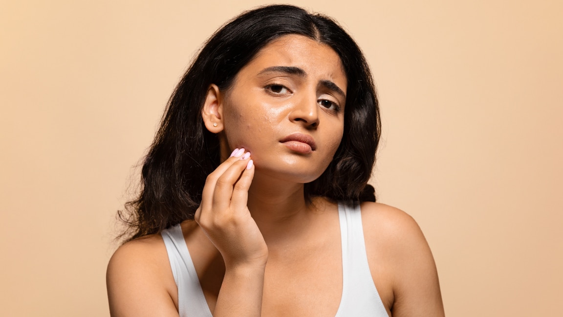 Image of Summer Skincare Routine for Oily Skin: Steps & Natural Care Tips