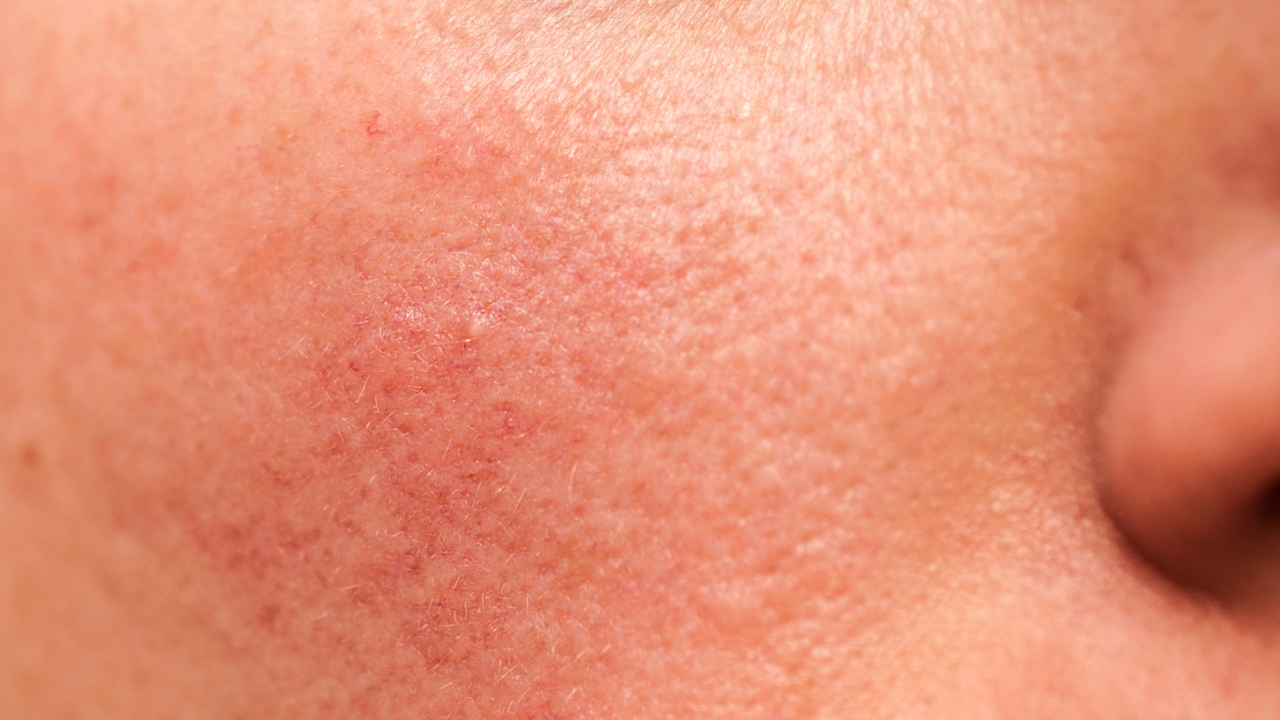 For Sensitive Skin