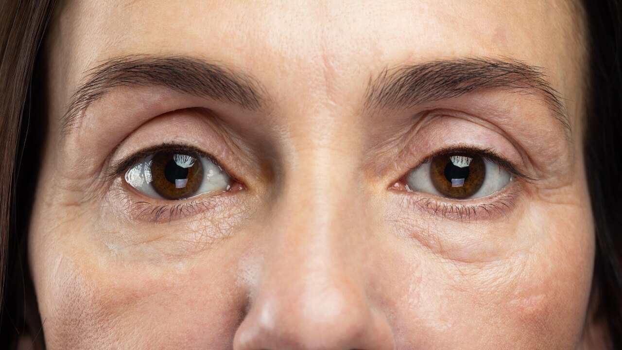 4. May Reduce Puffiness