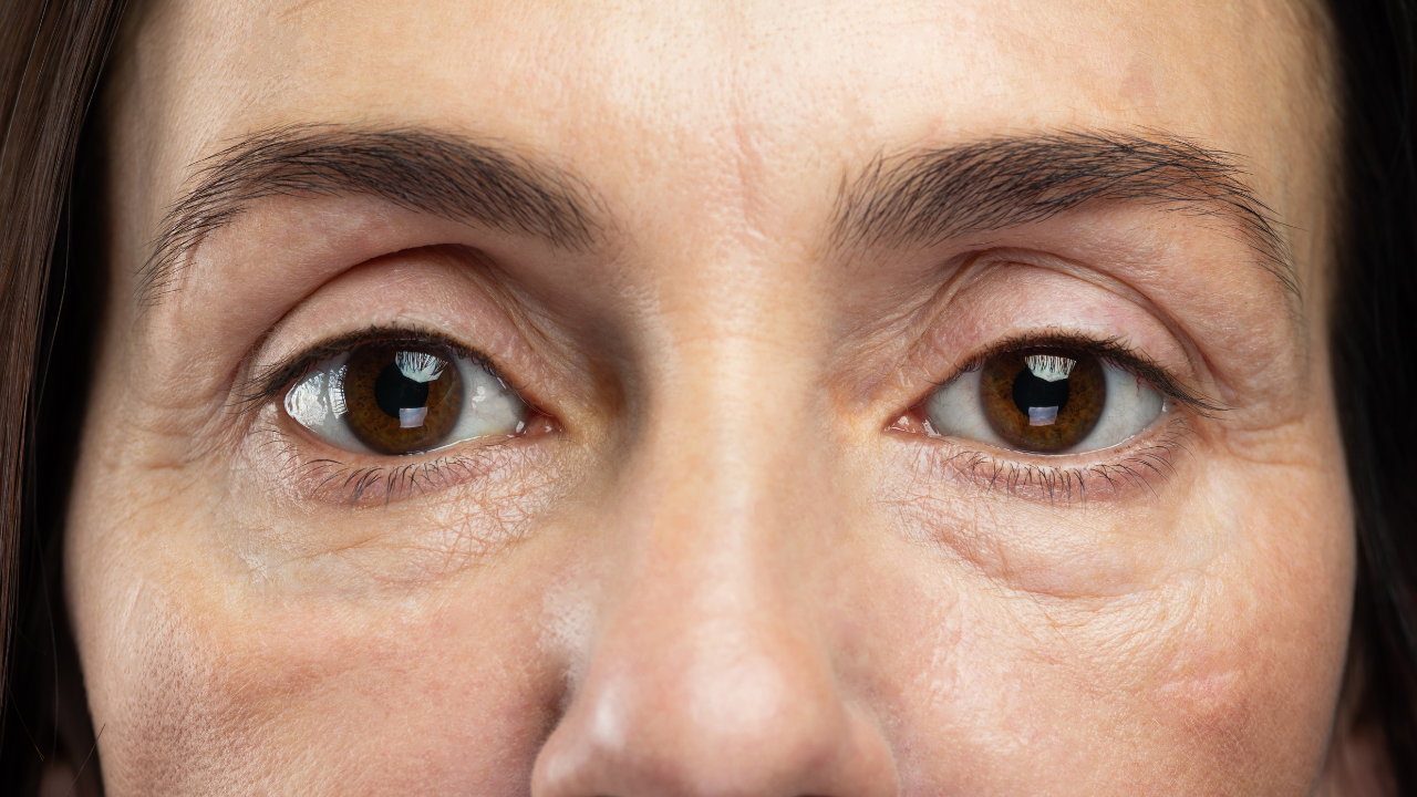 4. May Reduce Puffiness
