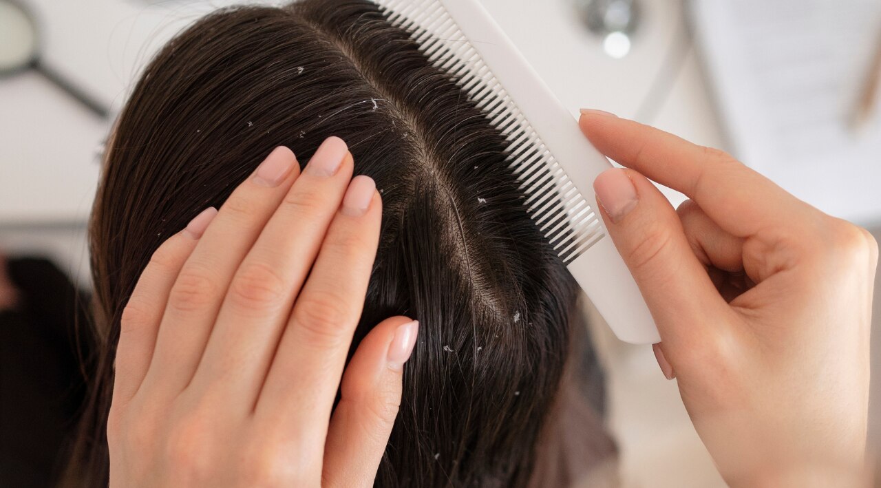 Fights Dandruff and Scalp Infections: