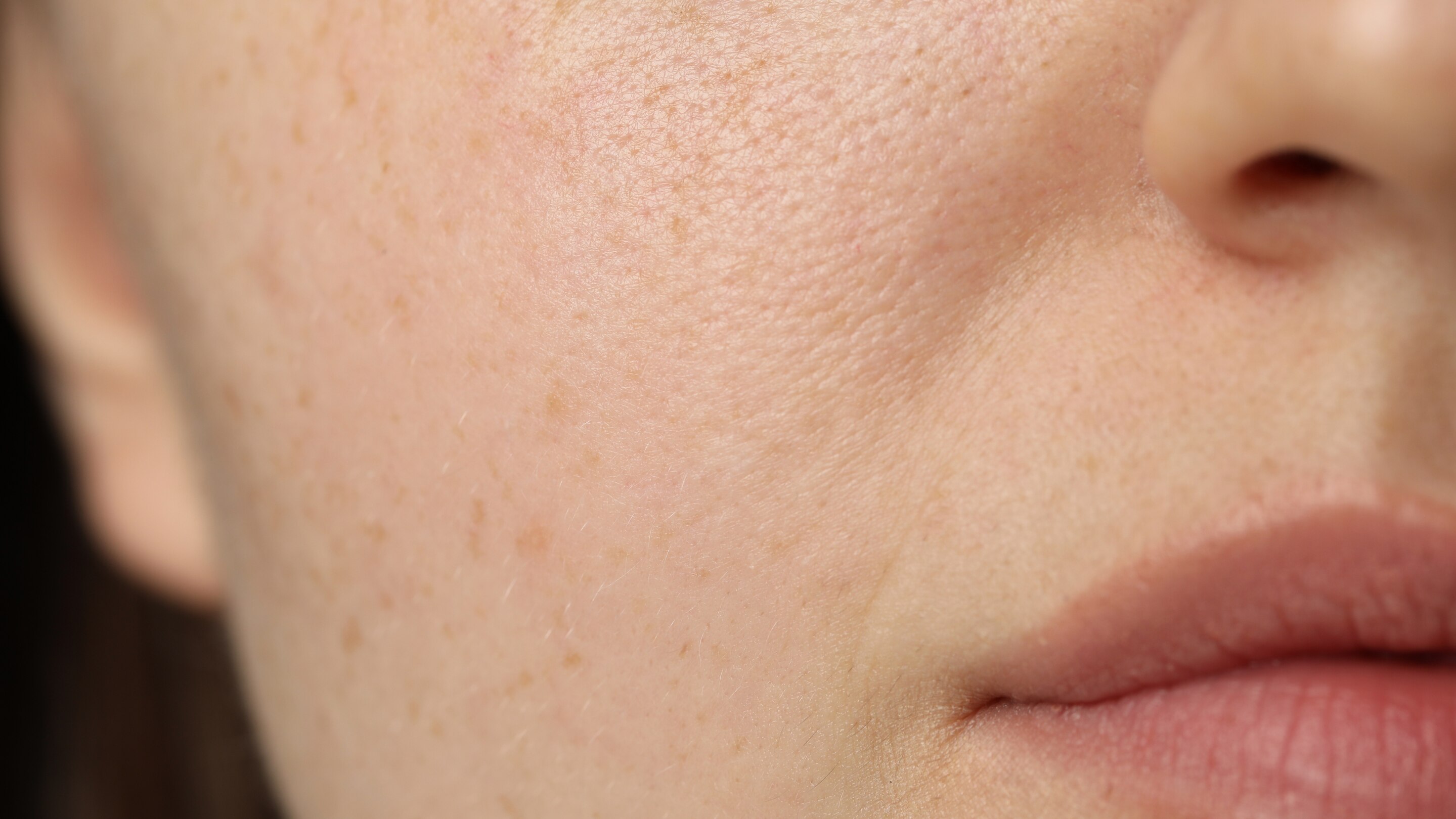 Causes of Open Pores