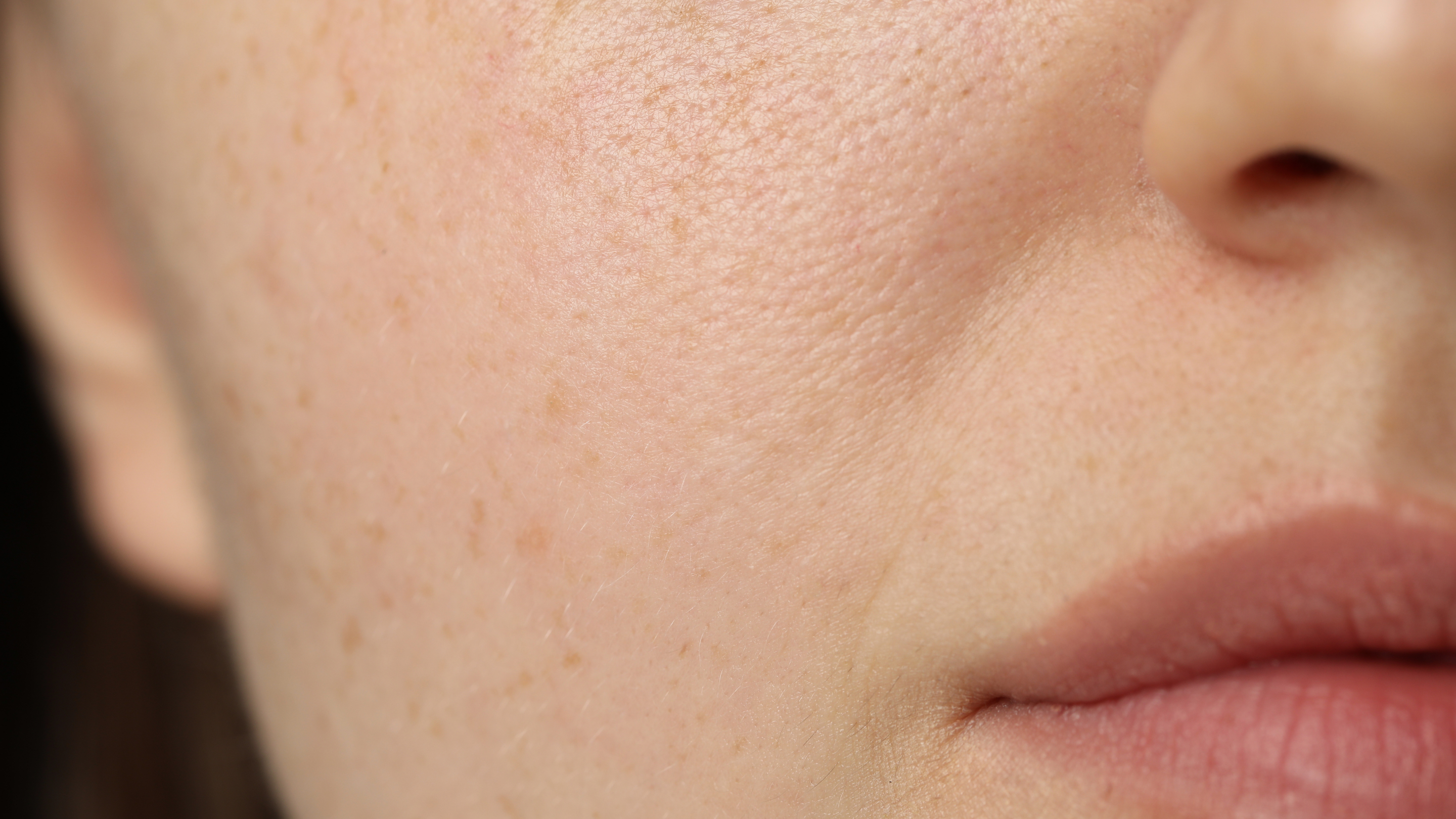 Causes of Open Pores