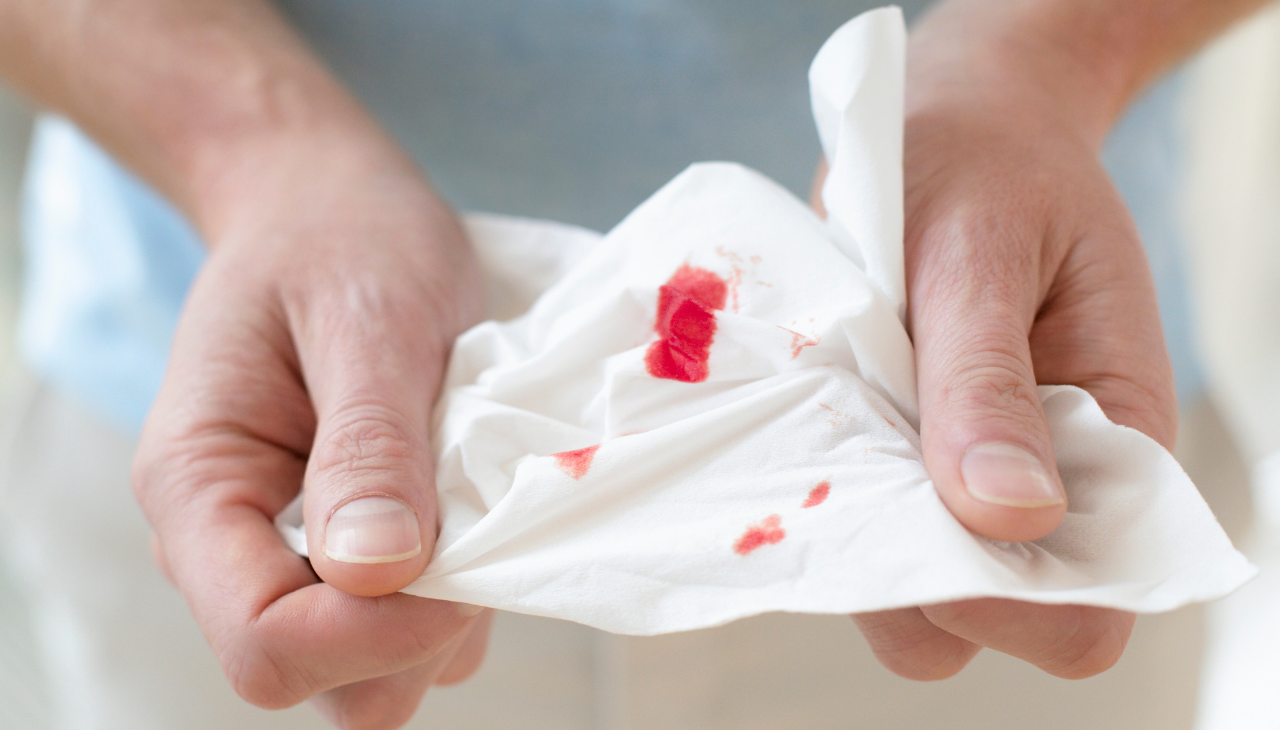 3. Risk of Bleeding