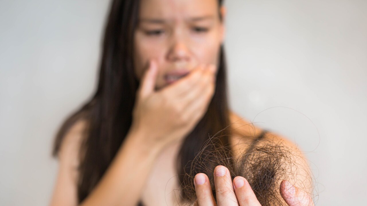 Causes of Low Hair Density