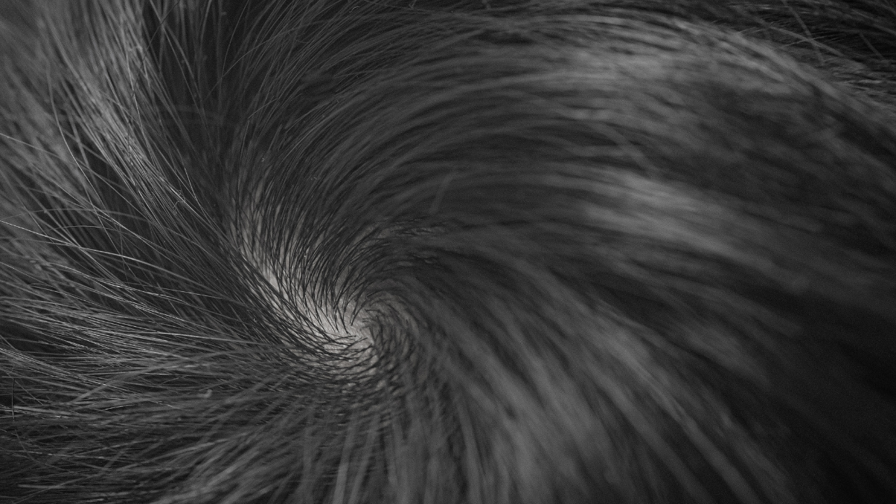 4. Improves Scalp Health