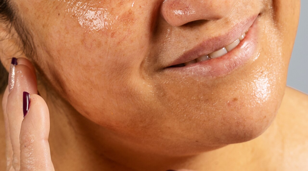 Excess Oil Absorption (Sebum Control) :