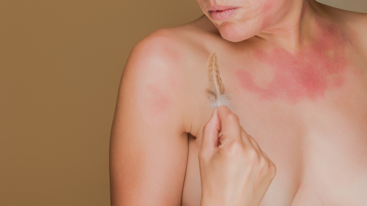 Soothes Itchiness and Discomfort: