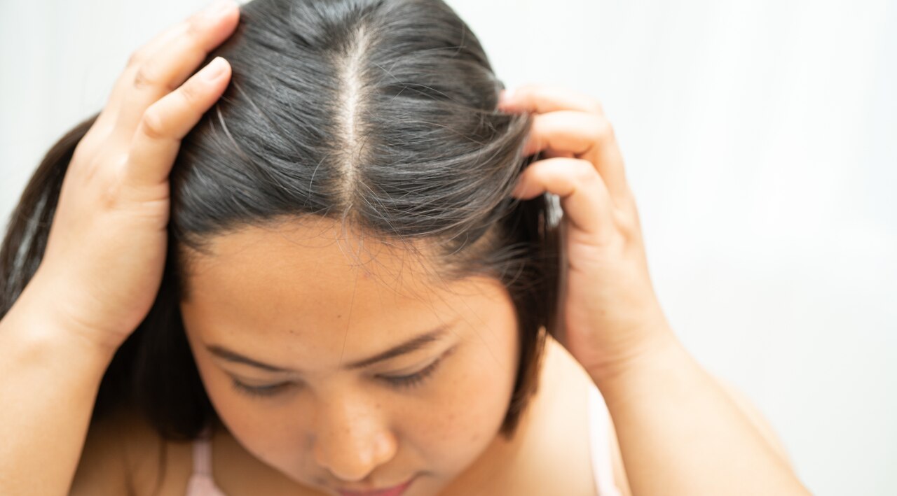 5. The Scalp Visibility Test