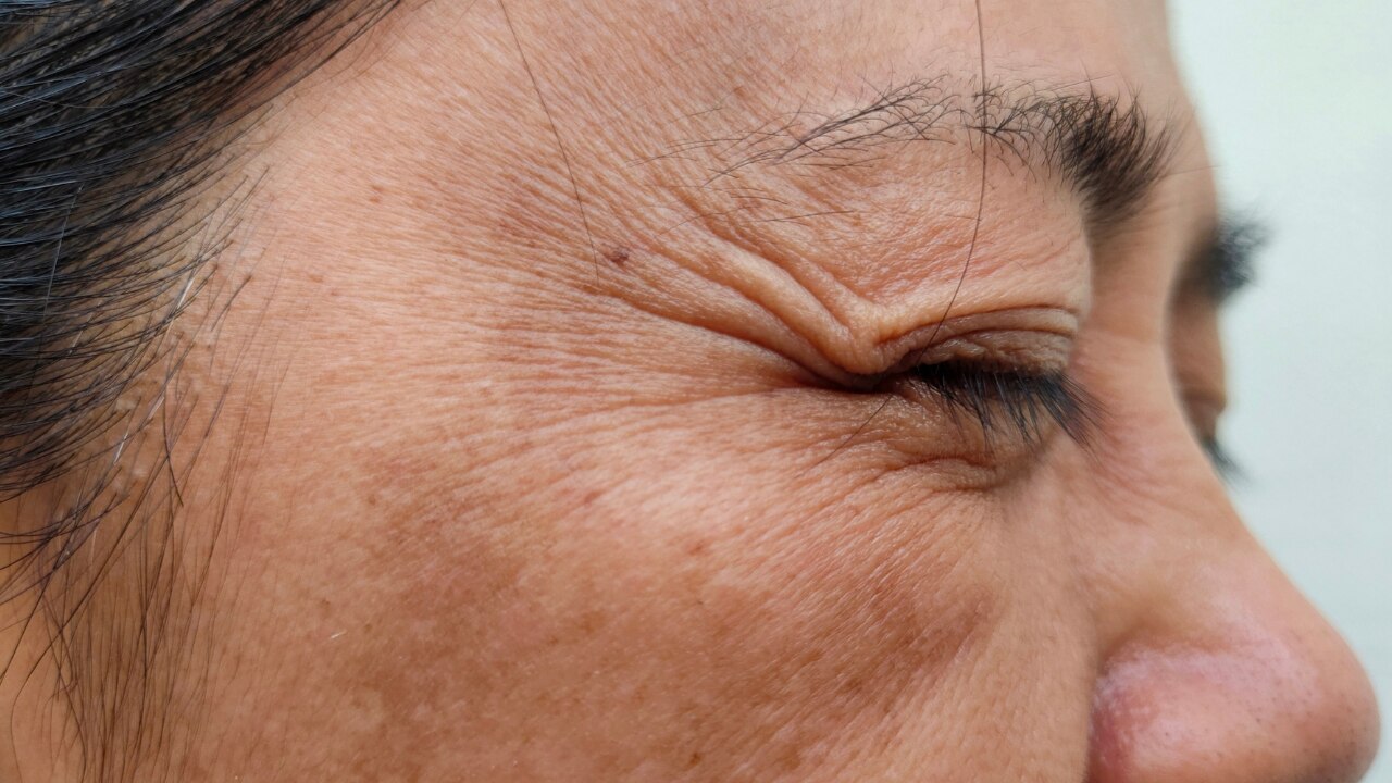3. Fights Signs of Aging