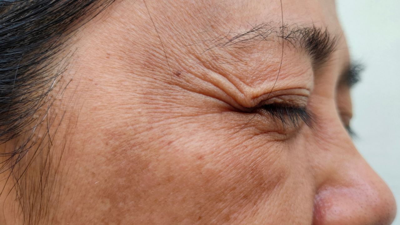 3. Fights Signs of Aging