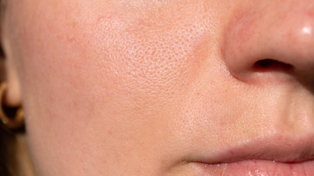 4. Improves Skin Texture