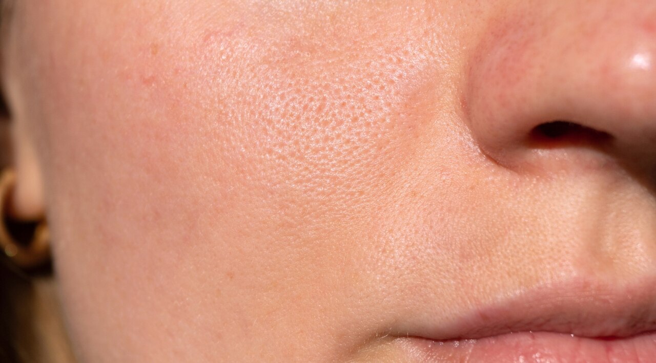 Improves Skin and Hair Health: