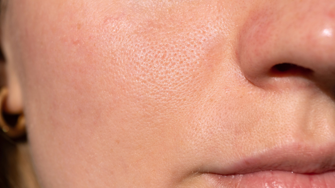 Improves Skin and Hair Health: