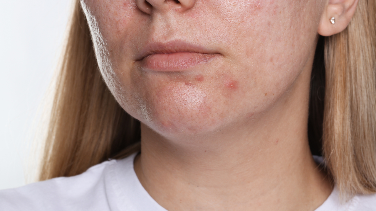 6. Reduces Inflammation