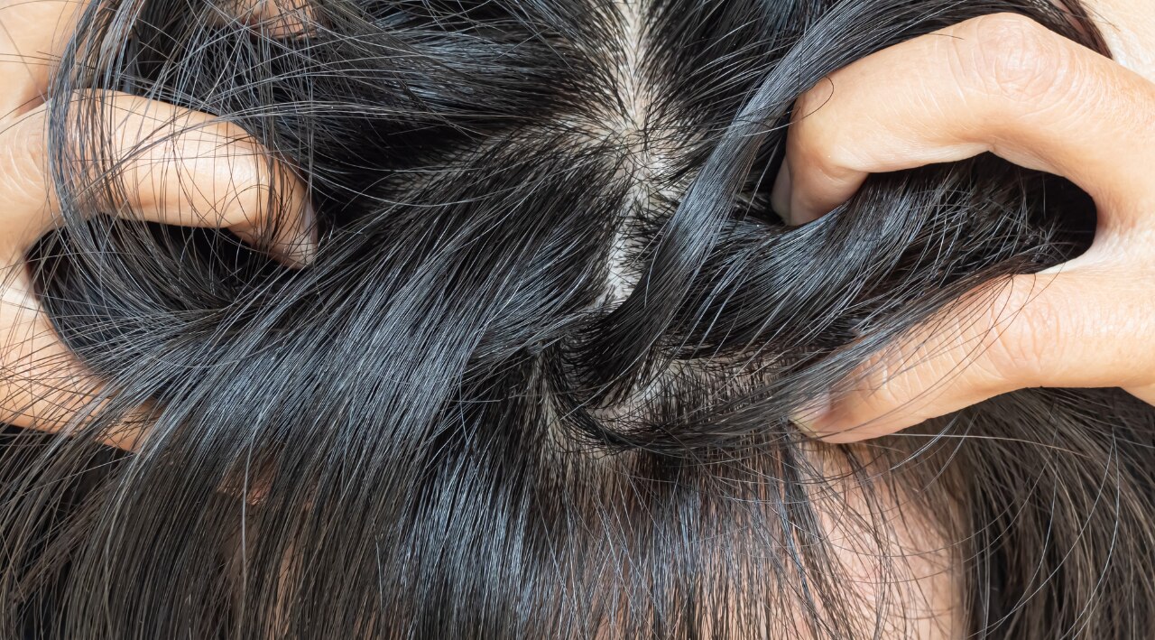 Your scalp is also having a hard time