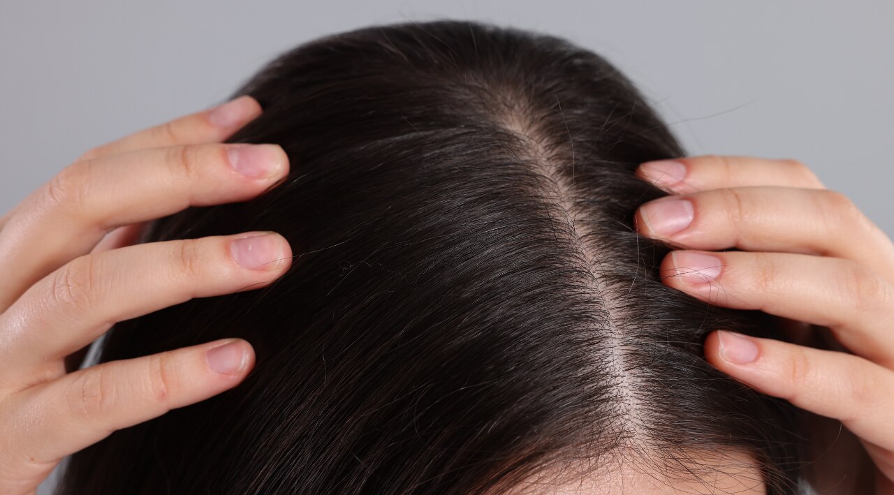 5. Keep Your Scalp Clean