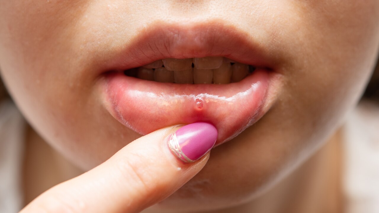 Are There Any Side Effects or Precautions?