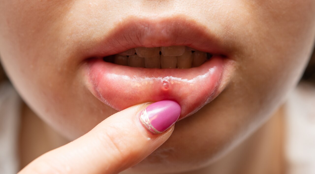 Are There Any Side Effects or Precautions?