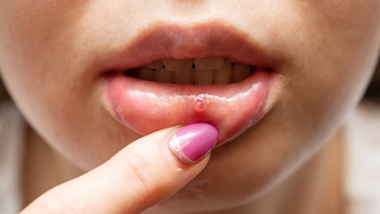 Are There Any Side Effects or Precautions?
