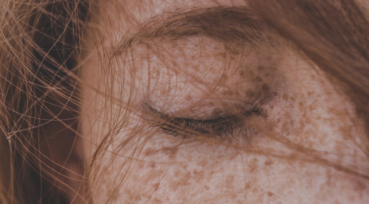 How to Prevent Freckles on Face