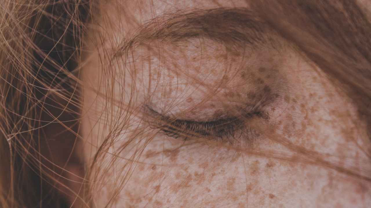 How to Prevent Freckles on Face